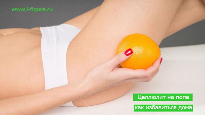целлюлит на попе как избавиться целлюлит на попе